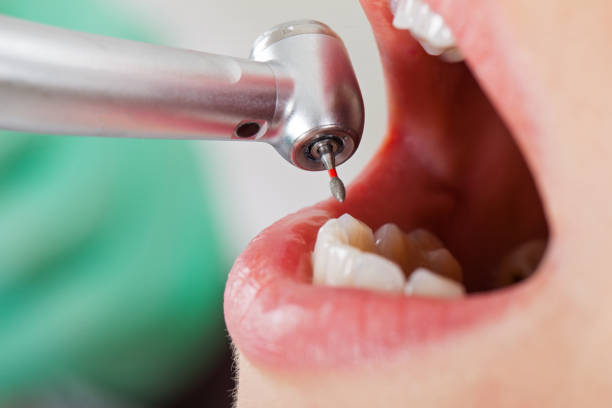 Best Emergency Treatment for Toothache in Richland, PA